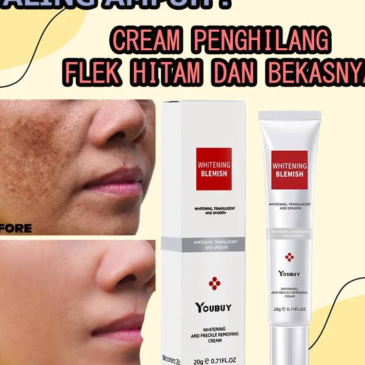Youbuy Whitening and Freckle Removing Cream, formulated to reduce dark spots and enhance skin radiance - Image 4
