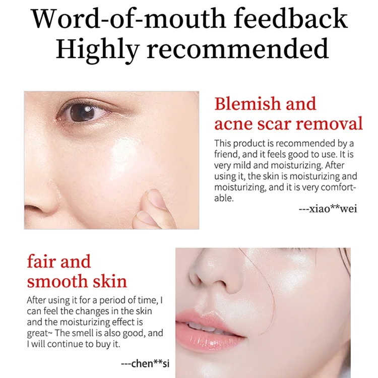 Youbuy Whitening and Freckle Removing Cream, formulated to reduce dark spots and enhance skin radiance - Image 2